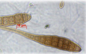 microscopic view of two long thin fungal spores