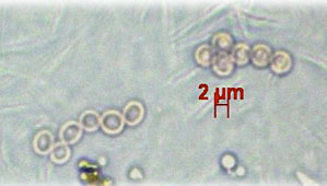 microscopic view of fungal spores in small round particles