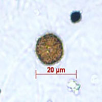 microscopic view of a circular fungal spore
