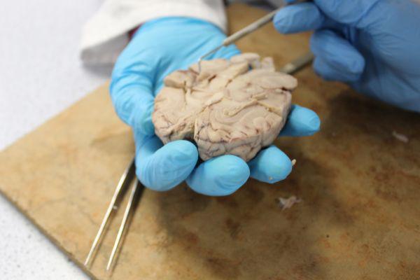 Brain Dissection 2