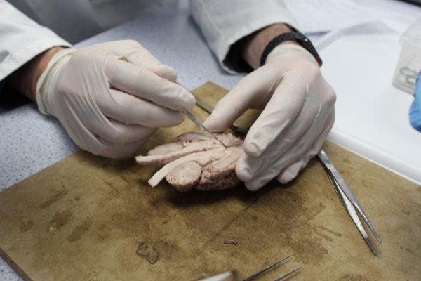 A close up of a person's gloved hands completing a brain dissection